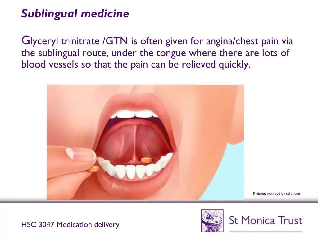 sublingual medicine