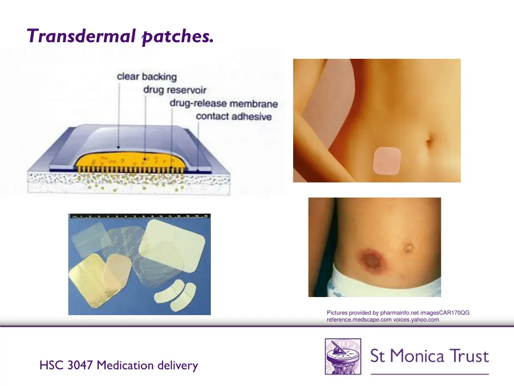 transdermal patches 1