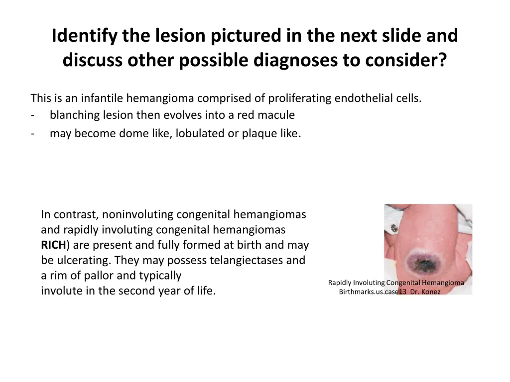 identify the lesion pictured in the next slide