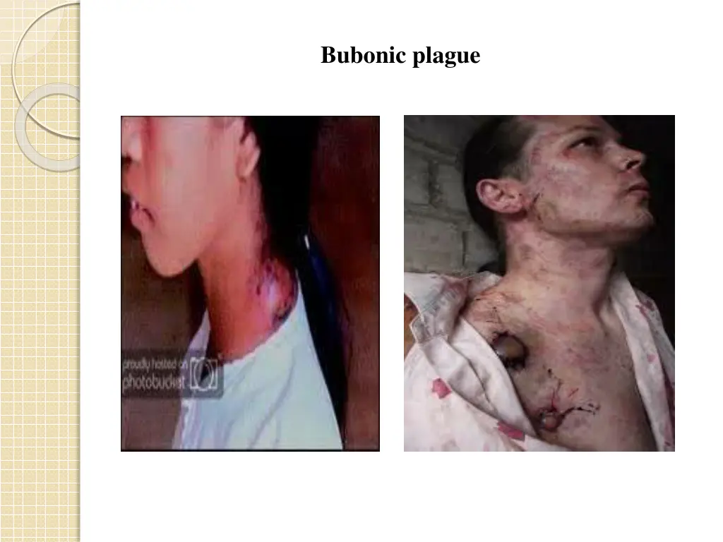 bubonic plague