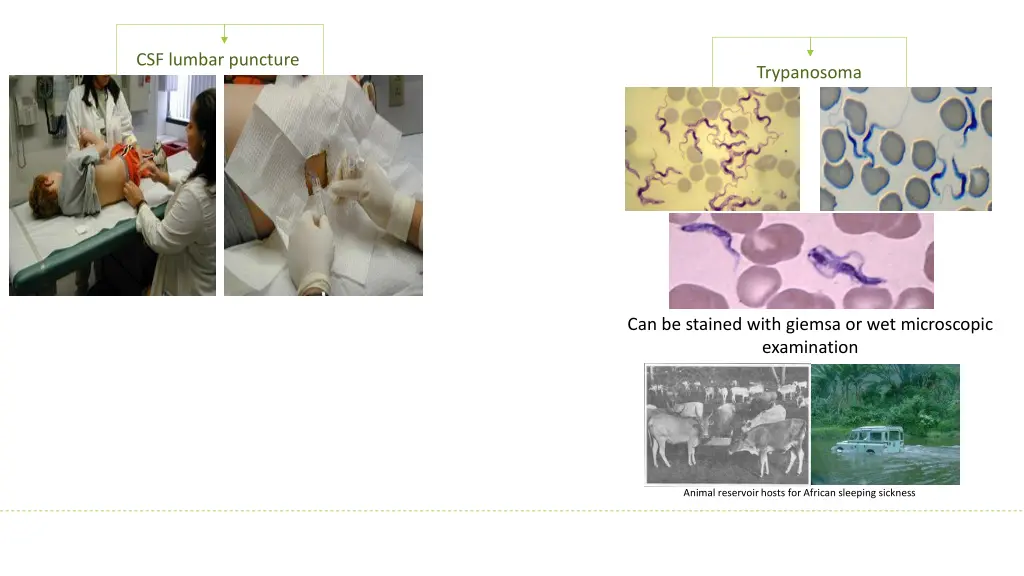 csf lumbar puncture