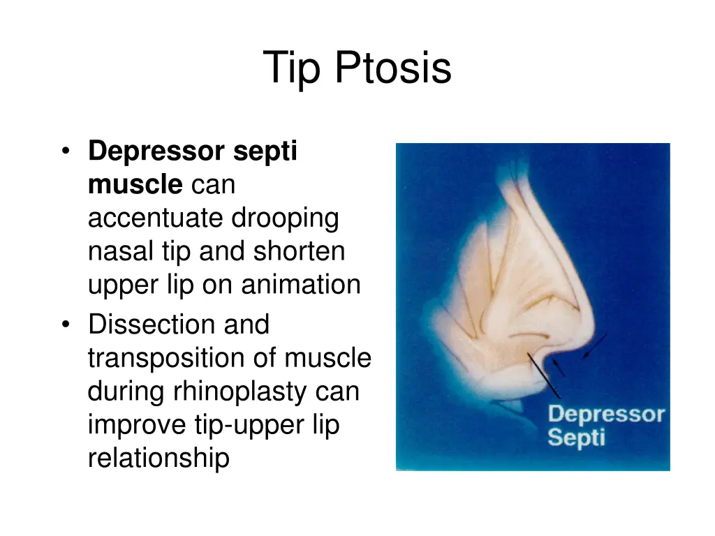 tip ptosis