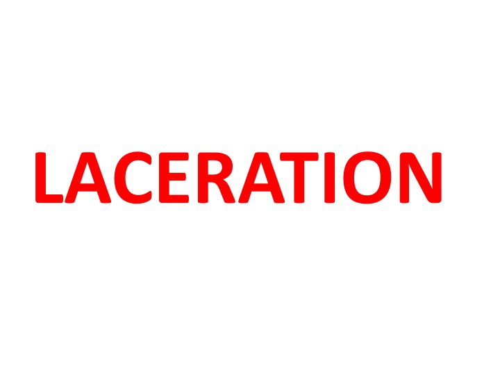 laceration