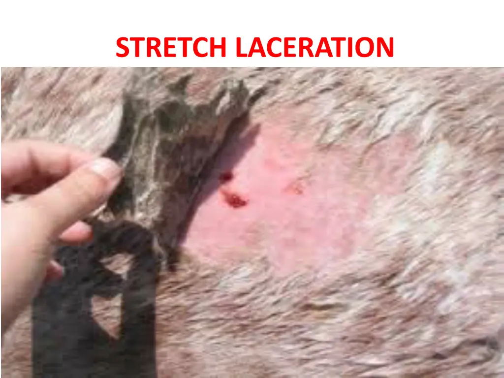 stretch laceration 1