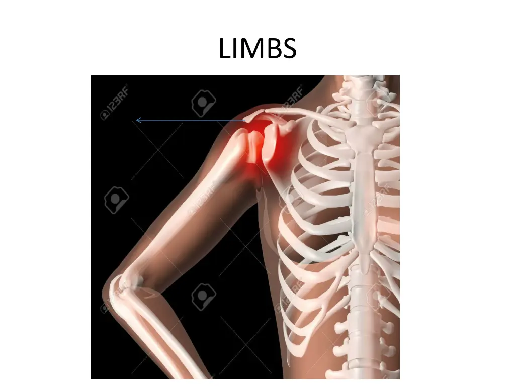 limbs 1