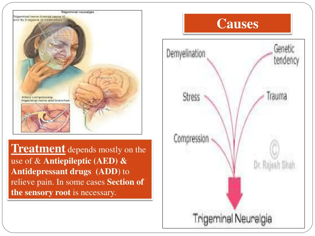 causes