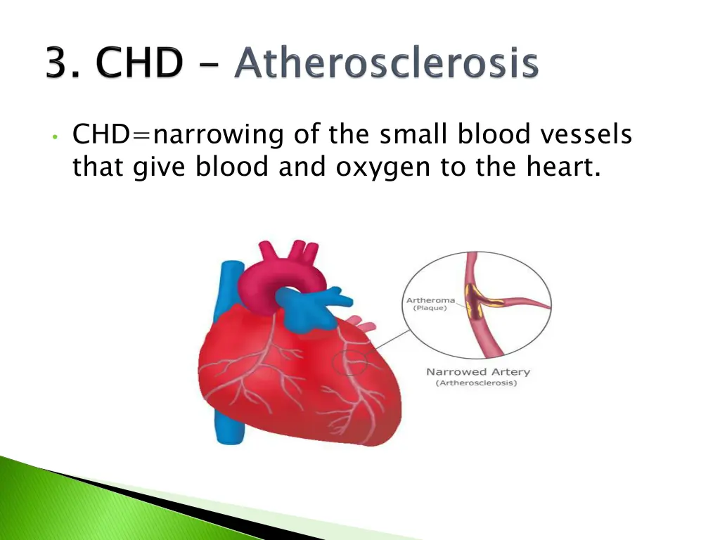 chd narrowing of the small blood vessels that