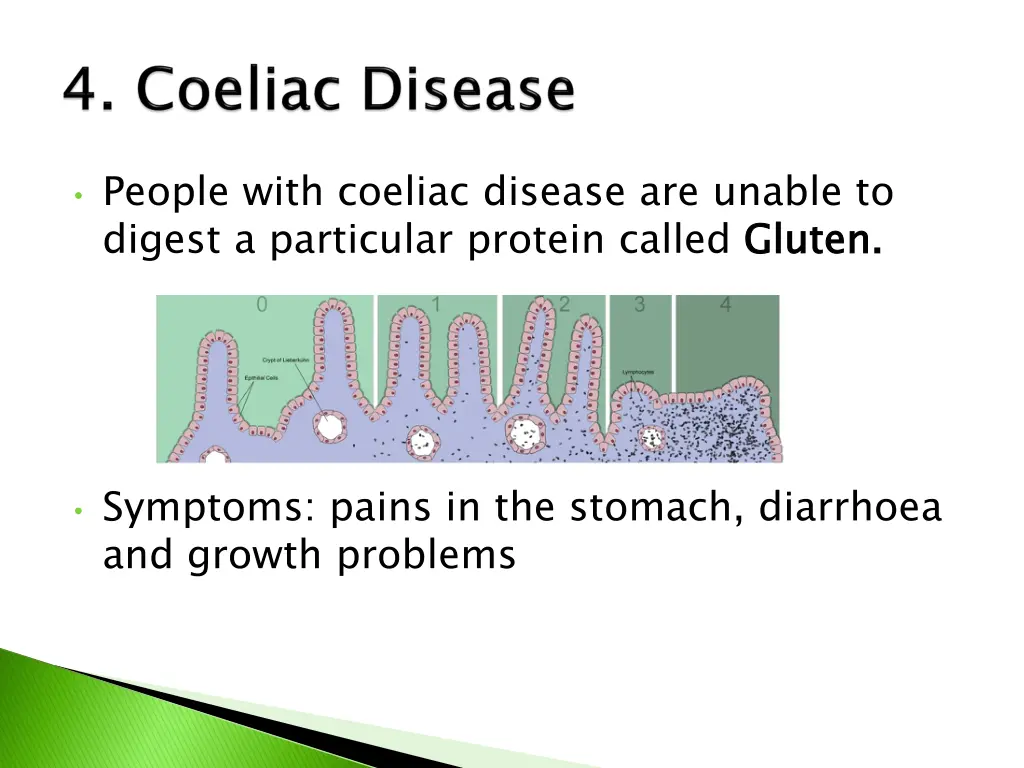 people with coeliac disease are unable to digest