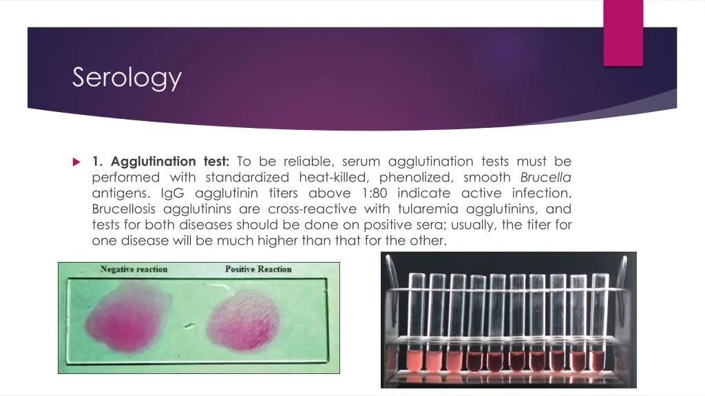 serology 1