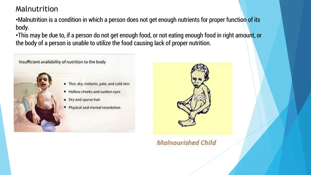 malnutrition