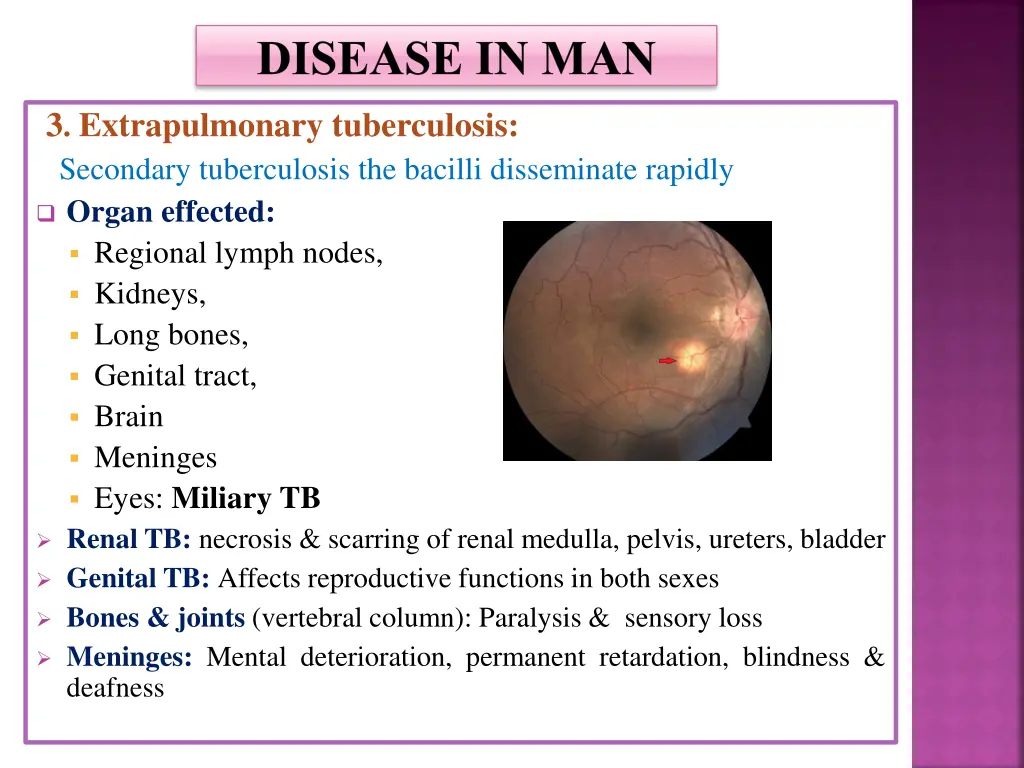 disease in man 2