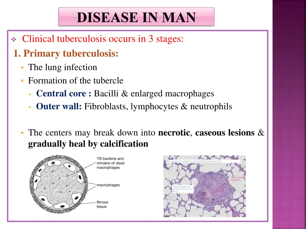 disease in man