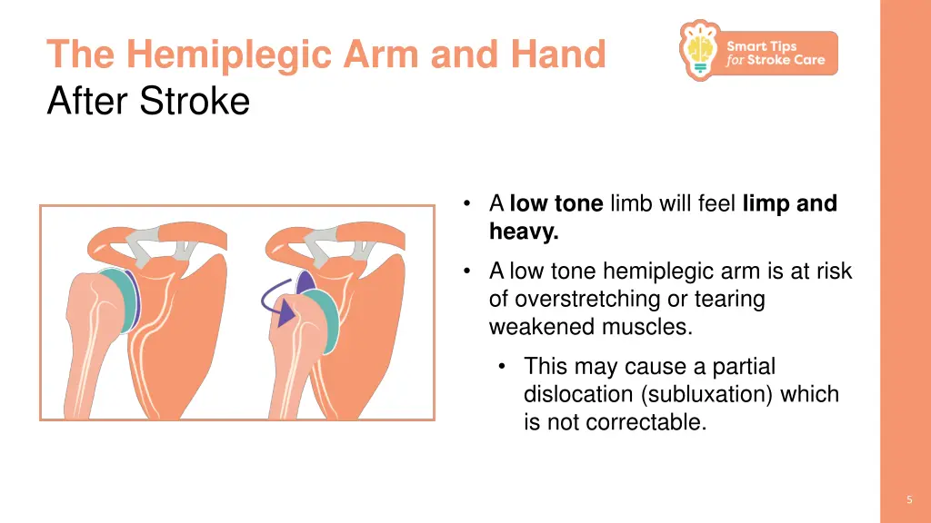 the hemiplegic arm and hand after stroke 3