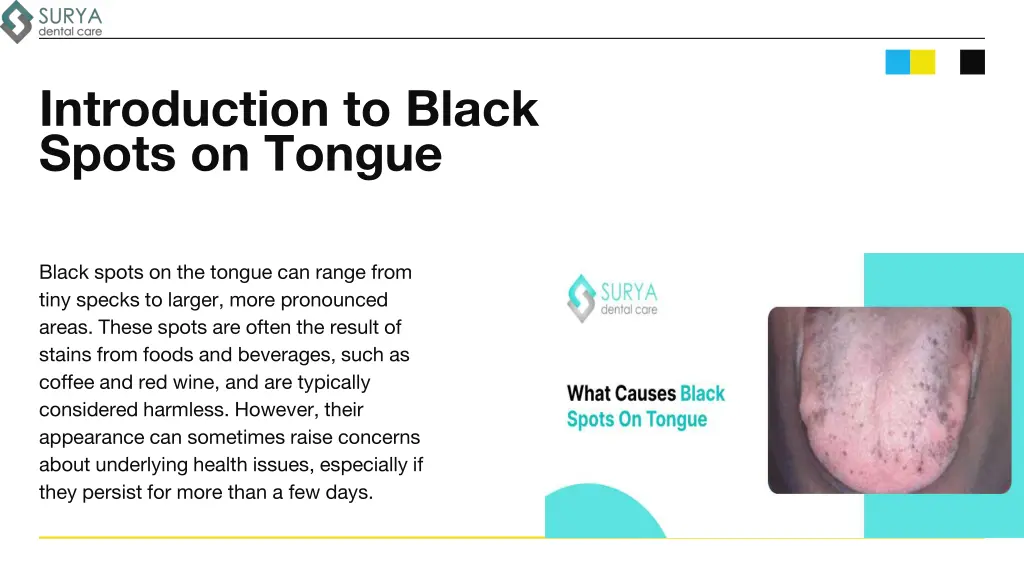 introduction to black spots on tongue