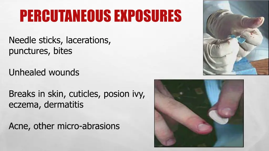 percutaneous exposures