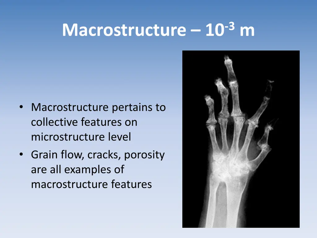 macrostructure 10 3 m