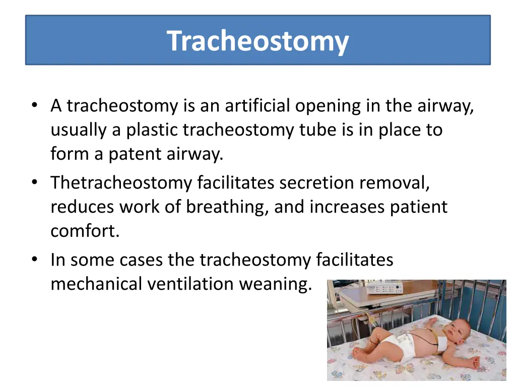 tracheostomy