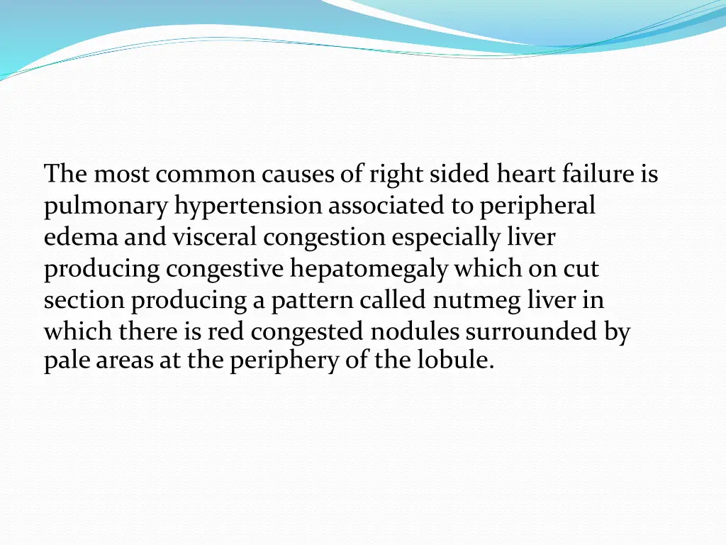 the most common causes of right sided heart