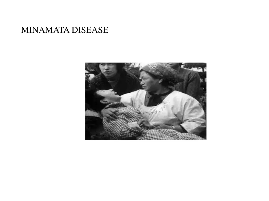 minamata disease