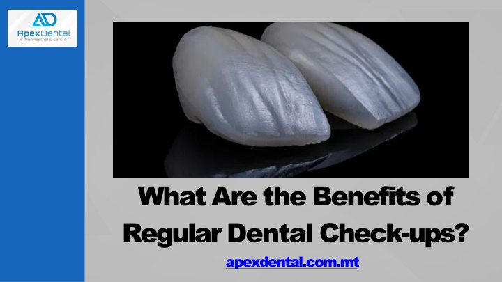 what are the benefits of regular dental check