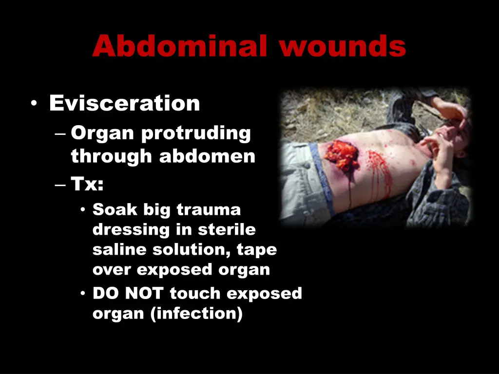 abdominal wounds