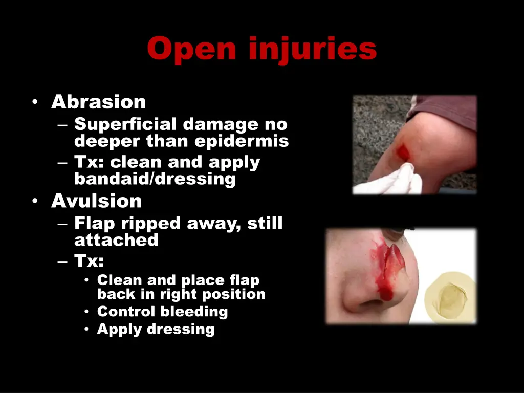 open injuries