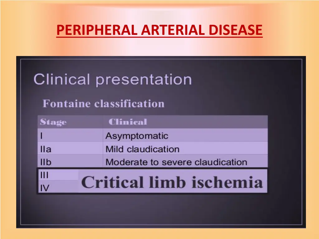 peripheral arterial disease 12