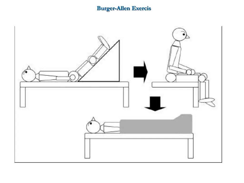 burger allen exercis