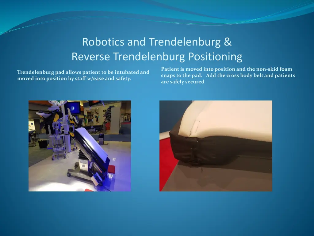 robotics and trendelenburg reverse trendelenburg