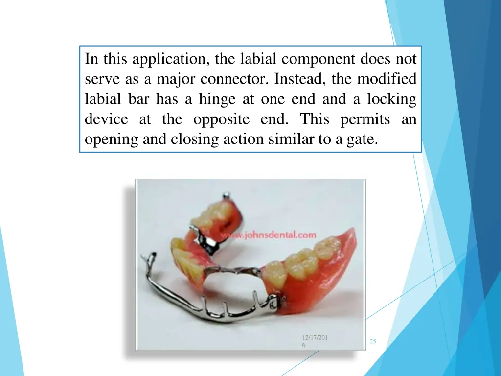 in this application the labial component does