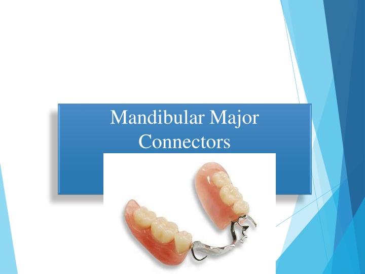 mandibular major connectors