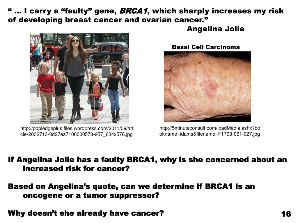 i carry a faulty gene brca1 of developing breast