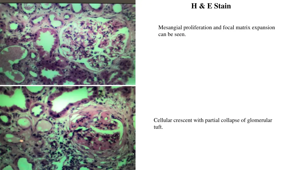 h e stain