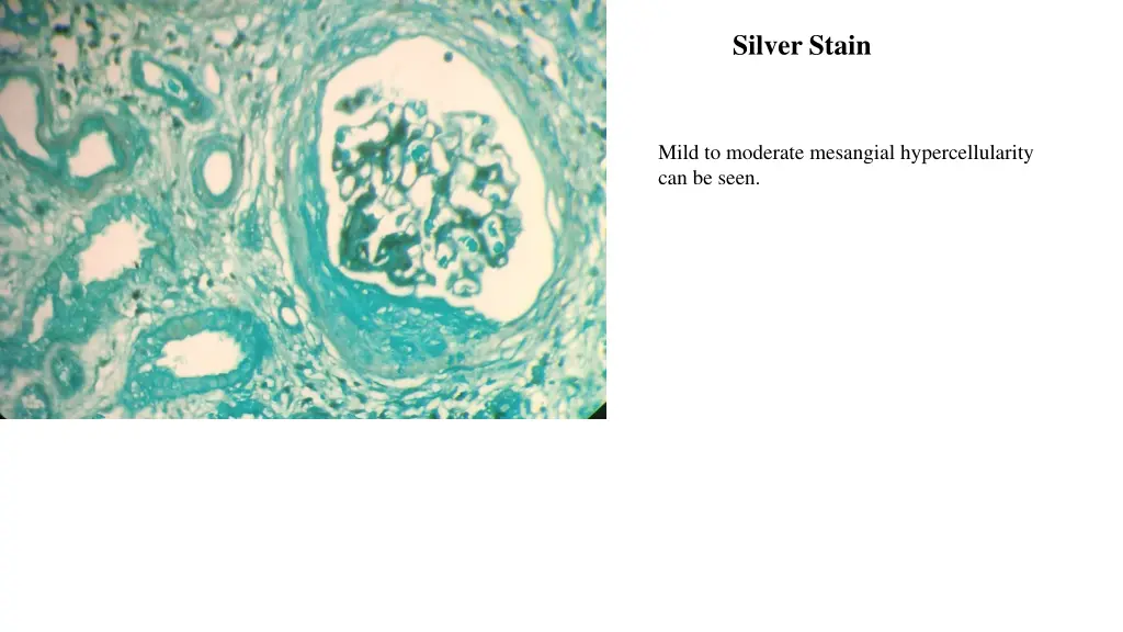 silver stain