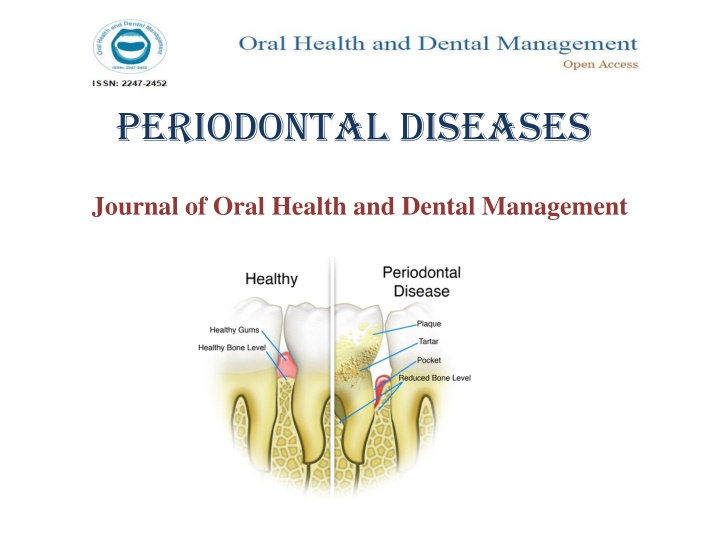 periodontal diseases