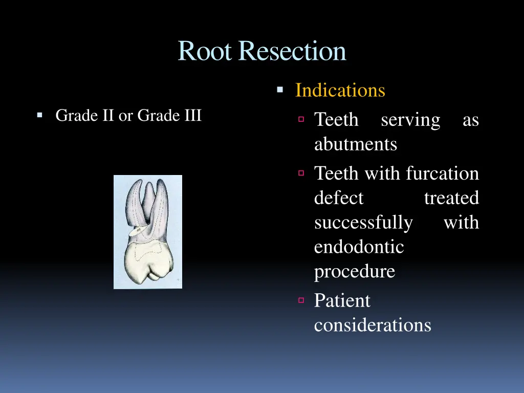 root resection