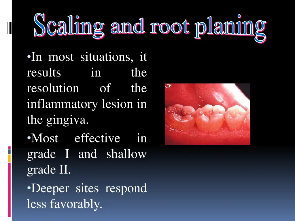 scaling and root planing