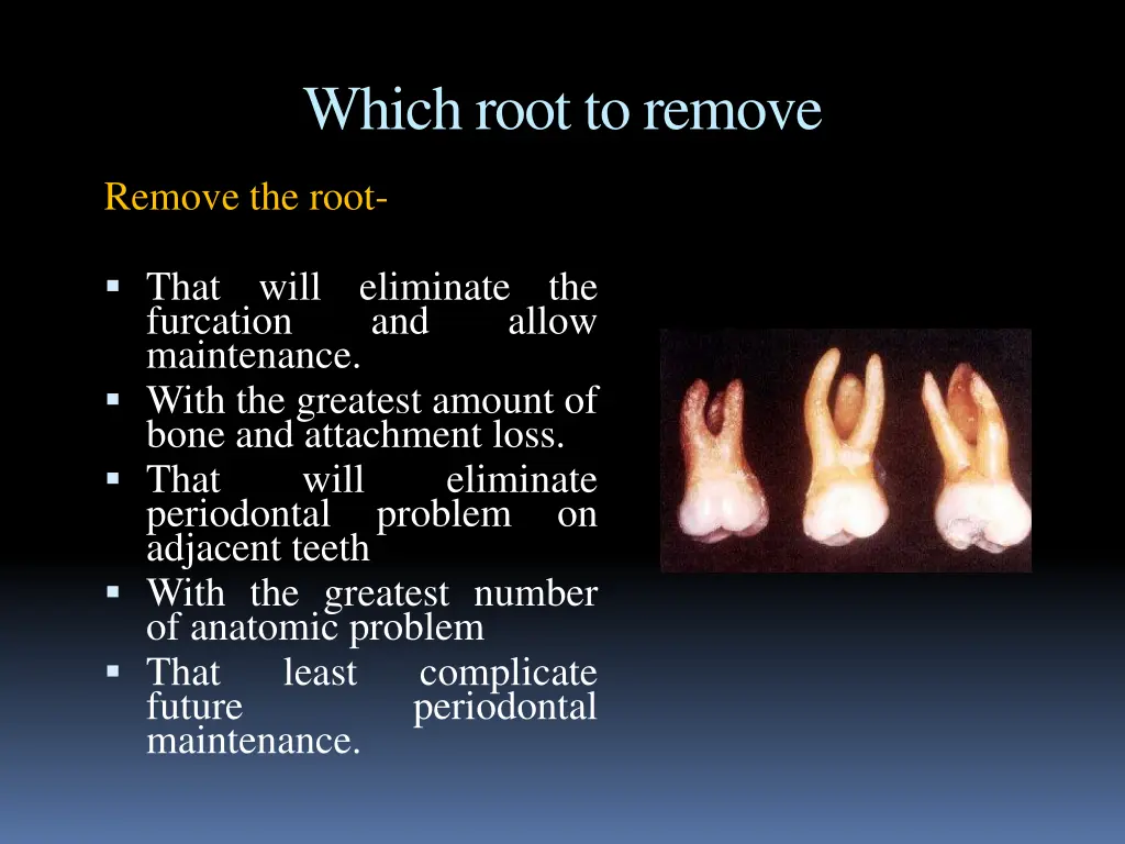 which root to remove