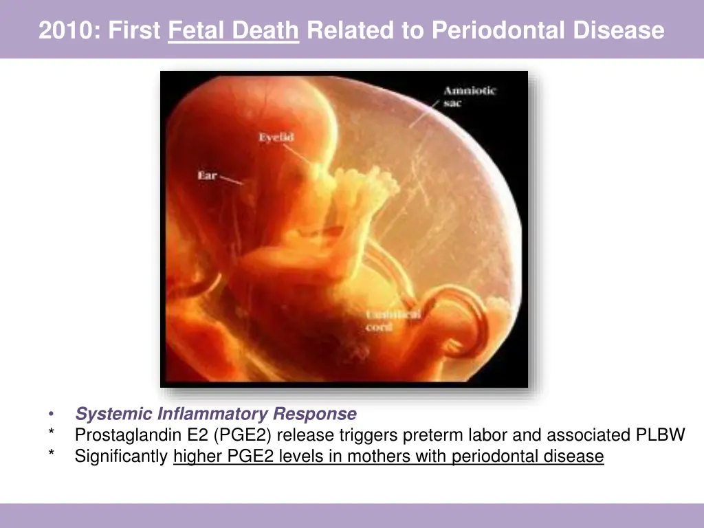 2010 first fetal death related to periodontal