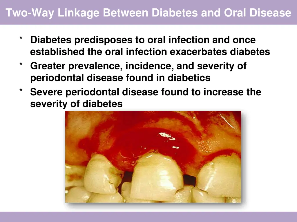 two way linkage between diabetes and oral disease