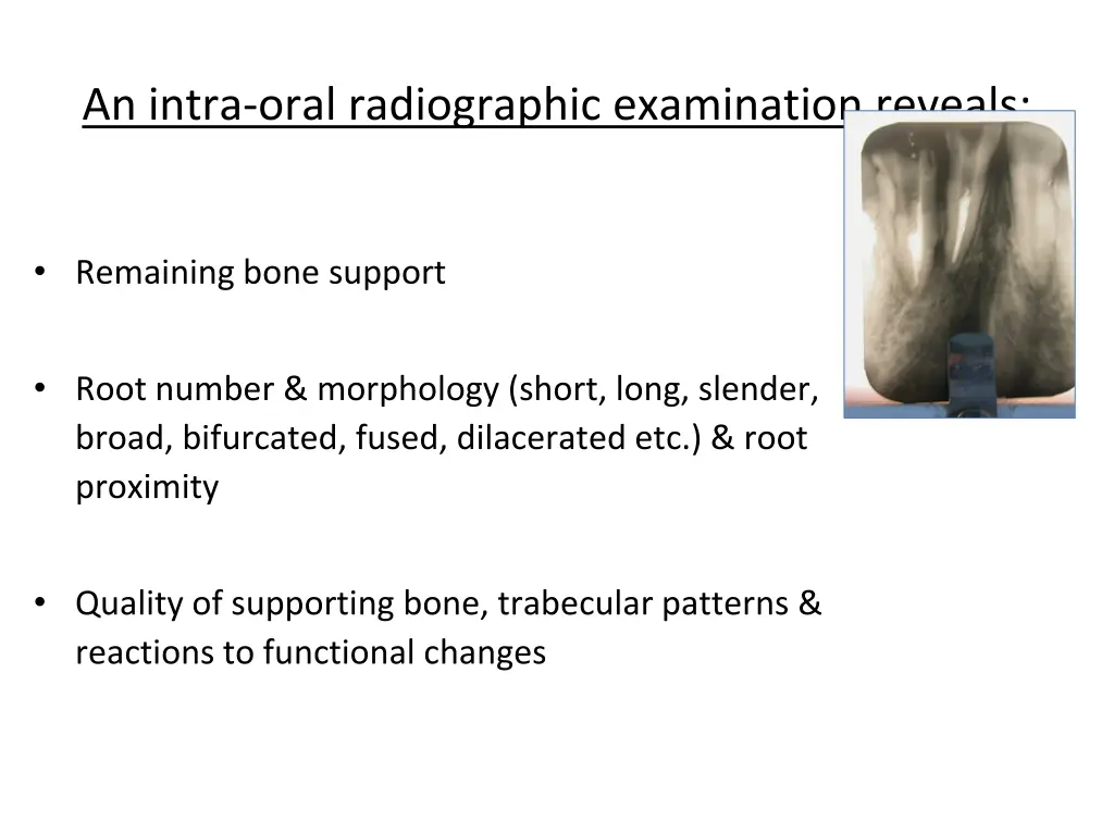 an intra oral radiographic examination reveals