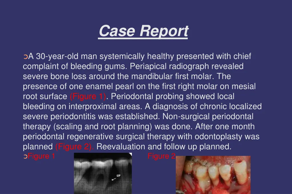 case report