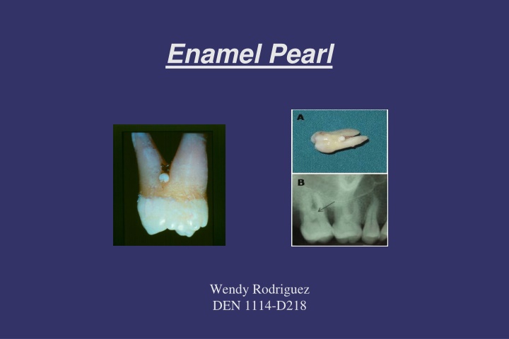 enamel pearl