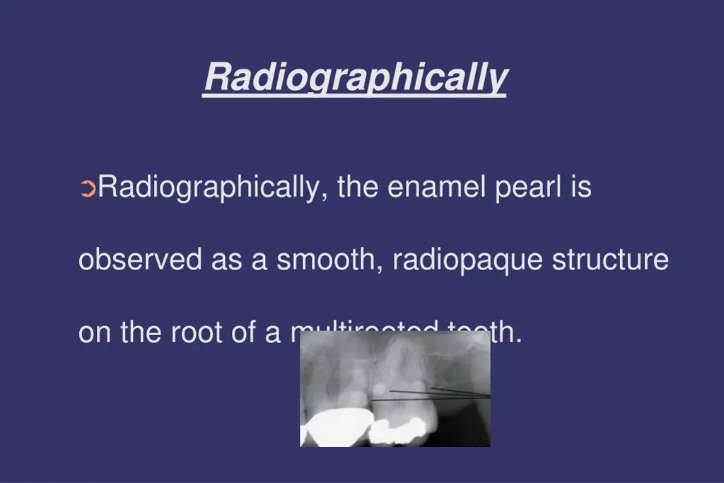 radiographically