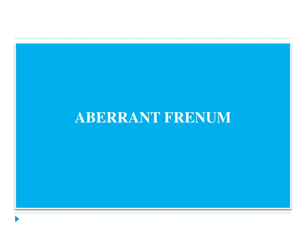 aberrant frenum