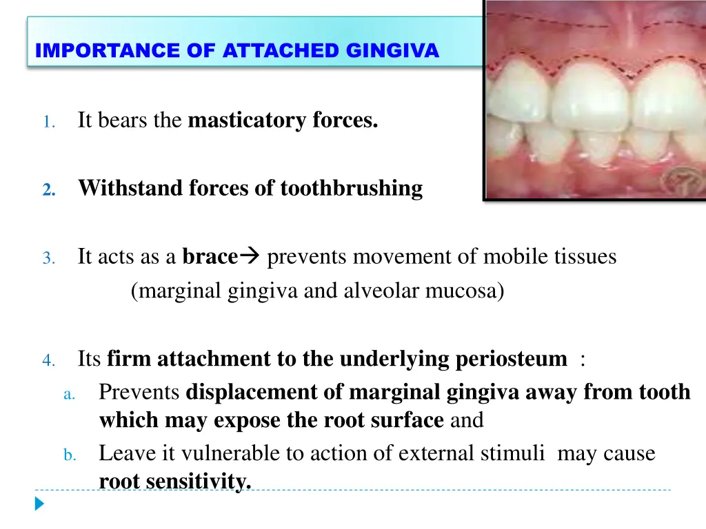 importance of attached gingiva