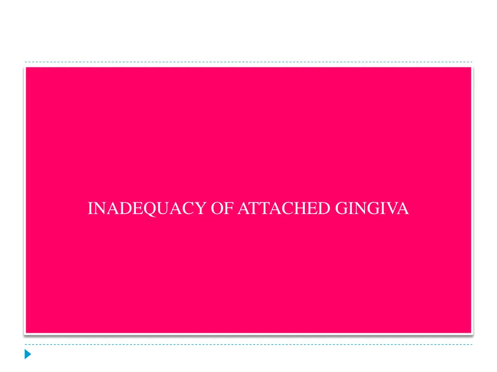 inadequacy of attached gingiva