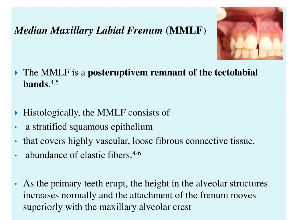 median maxillary labial frenum mmlf