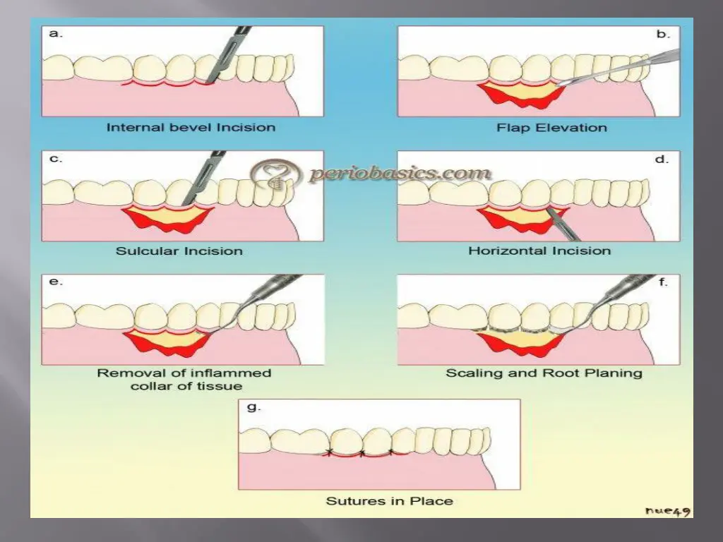 slide16