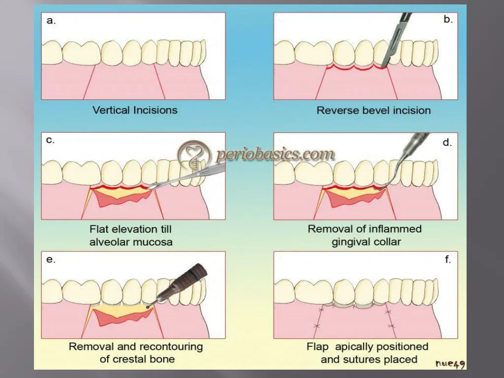 slide21